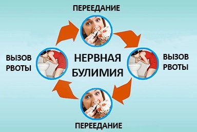 Лечение булимии в Каменоломнях